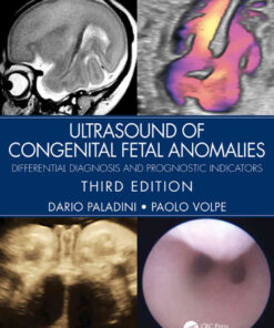 Ultrasound of Congenital Fetal Anomalies: Differential Diagnosis and Prognostic Indicators eBook