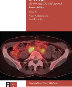 Gynaecological Oncology for the MRCOG and Beyond eBook