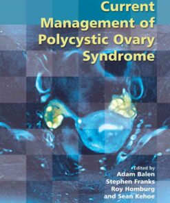 Current Management of Polycystic Ovary Syndrome eBook