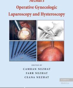 Nezhat's Operative Gynecologic Laparoscopy and Hysteroscopy eBook