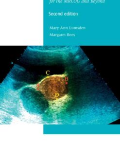 Menstrual Problems for the MRCOG and Beyond eBook