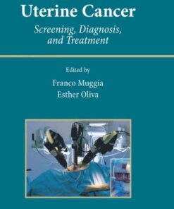 Uterine Cancer: Screening, Diagnosis, and Treatment eBook