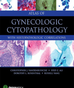 Atlas of Gynecologic Cytopathology: with Histopathologic Correlations eBook
