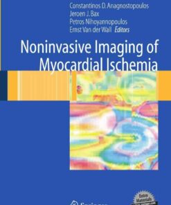 Noninvasive Imaging of Myocardial Ischemia eBook