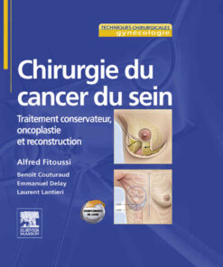 Chirurgie du cancer du sein: Traitement conservateur, oncoplastie et reconstruction eBook
