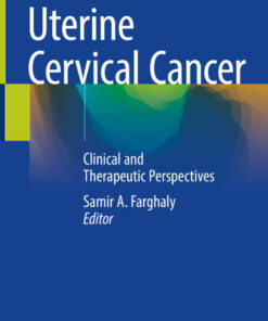 Uterine Cervical Cancer: Clinical and Therapeutic Perspectives eBook