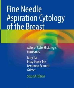 Fine Needle Aspiration Cytology of the Breast: Atlas of Cyto-Histologic Correlates eBook