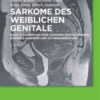 Andere seltene Sarkome, Mischtumoren, genitale Sarkome und Schwangerschaft eBook