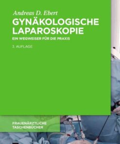 Gynäkologische Laparoskopie: Ein Wegweiser für die Praxis mit Hinweisen für das ambulante Operieren und die Roboter-Chirurgie eBook