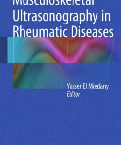 Musculoskeletal Ultrasonography in Rheumatic Diseases eBook