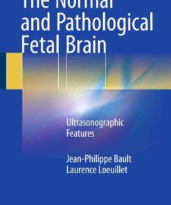 The Normal and Pathological Fetal Brain: Ultrasonographic Features eBook