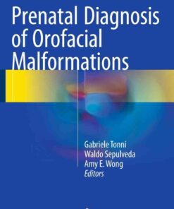 Prenatal Diagnosis of Orofacial Malformations eBook