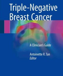 Triple-Negative Breast Cancer: A Clinician’s Guide eBook