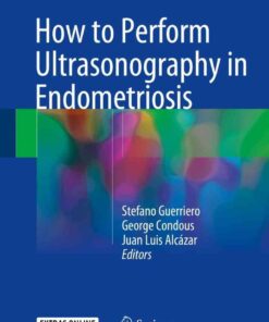 How to Perform Ultrasonography in Endometriosis eBook
