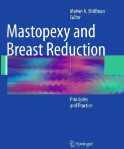 Mastopexy and Breast Reduction: Principles and Practice eBook