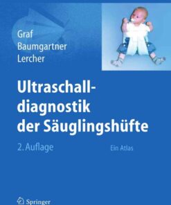 Ultraschalldiagnostik der Säuglingshüfte: Ein Atlas eBook