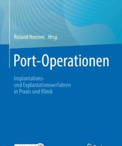 Port-Operationen: Implantations- und Explantationsverfahren in Praxis und Klinik eBook