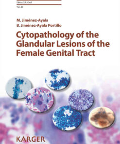 Cytopathology of the Glandular Lesions of the Female Genital Tract eBook