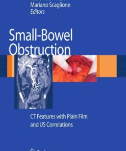 Small-Bowel Obstruction: CT Features with Plain Film and US correlations eBook