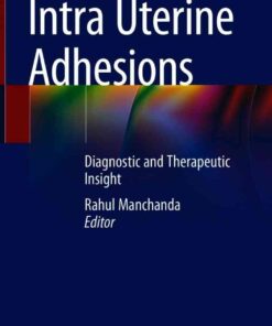 Intra Uterine Adhesions: Diagnostic and Therapeutic Insight eBook