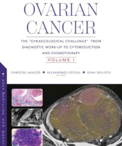 Ovarian Cancer: The “Gynaecological Challenge” from Diagnostic Work-Up to Cytoreduction and Chemotherapy. Volume 1 eBook