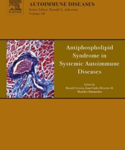 Antiphospholipid Syndrome in Systemic Autoimmune Diseases eBook