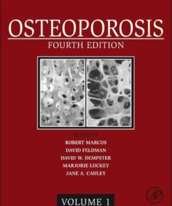 Osteoporosis: Two-Volume SetNewer Edition Available, 4th Edition eBook
