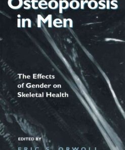 Osteoporosis in Men: The Effects of Gender on Skeletal Health eBook