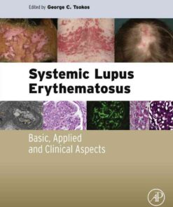 Systemic Lupus Erythematosus: Basic, Applied and Clinical Aspects eBook