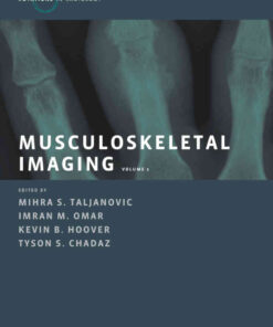 Musculoskeletal Imaging Volume 1: Trauma, Arthritis, and Tumor and Tumor-Like Conditions, 1st Edition eBook