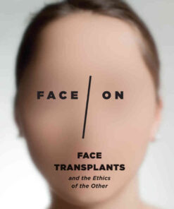 Face/On: Face Transplants and the Ethics of the Other, 1st Edition eBook
