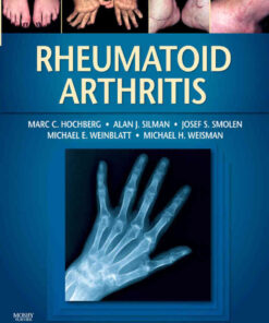Rheumatoid Arthritis - Electronic, 1st Edition eBook