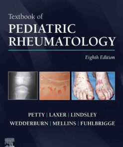 Textbook of Pediatric Rheumatology E-Book, 8th Edition eBook