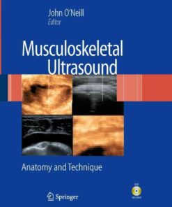 Musculoskeletal Ultrasound: Anatomy and Technique, 1st Edition eBook