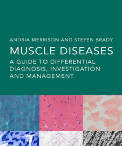 Muscle Diseases: A Guide to Differential Diagnosis, Investigation and Management, 1st Edition eBook