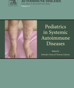 Pediatrics in Systemic Autoimmune Diseases, 2nd Edition eBook