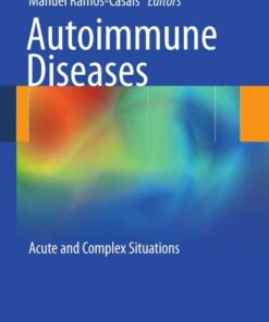Autoimmune Diseases: Acute and Complex Situations eBook