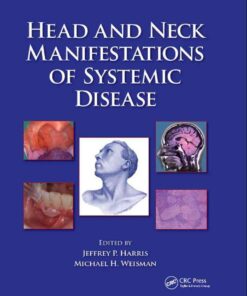 Head and Neck Manifestations of Systemic Disease, 1st Edition eBook