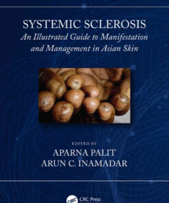 Systemic Sclerosis: An Illustrated Guide to Manifestation and Management in Asian Skin, 1st Edition eBook