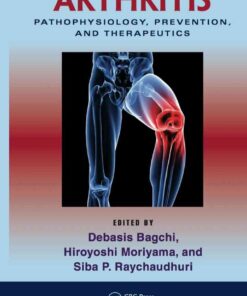 Arthritis: Pathophysiology, Prevention, and Therapeutics, 1st Edition eBook