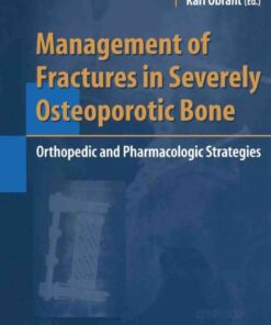 Management of Fractures in Severely Osteoporotic Bone: Orthopedic and Pharmacologic Strategies, 1st Edition eBook