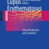 Lupus Erythematosus: Clinical Evaluation and Treatment, 1st Edition eBook