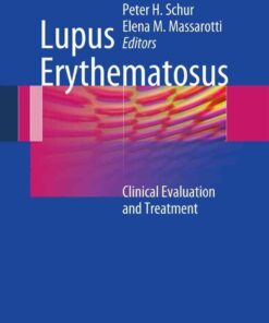 Lupus Erythematosus: Clinical Evaluation and Treatment, 1st Edition eBook