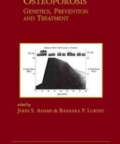 Osteoporosis: Genetics, Prevention and Treatment: Genetics, Prevention and Treatment, 1st Edition eBook