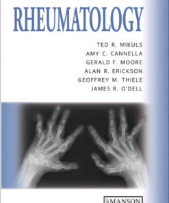 Rheumatology: A Color Handbook, 1st Edition eBook