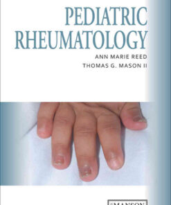 Pediatric Rheumatology: A Color Handbook, 1st Edition eBook