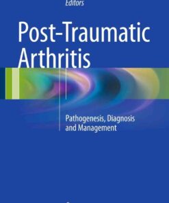 Post-Traumatic Arthritis: Pathogenesis, Diagnosis and Management eBook