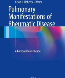 Pulmonary Manifestations of Rheumatic Disease: A Comprehensive Guide eBook
