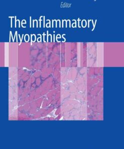 The Inflammatory Myopathies, 1st Edition eBook