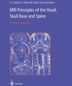 MRI Principles of the Head, Skull Base and Spine: A Clinical Approach eBook